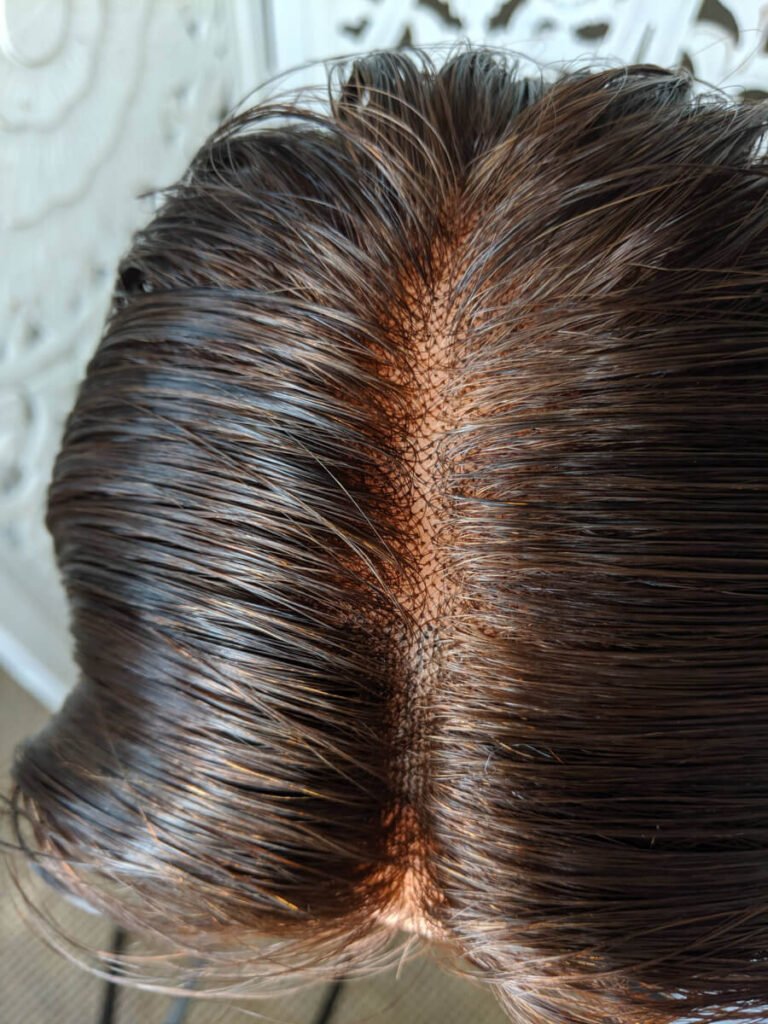 The Struggle with Knots